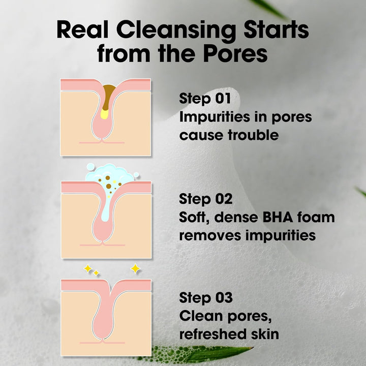 AHA BHA PHA 30 Days Miracle Acne Clear Foam – 3.38Oz, 100Ml – Korean Acne Face Wash for Smooth &amp; Clear Skin – Salicylic Acid Cleanser for Exfoliation &amp; Sebum Control – Korean Skin Care