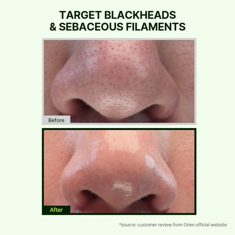 Mugwort Zero Film Cleansing Oil 6.76 Fl.Oz. 200Ml ㅣDaily Makeup Blackhead Removal No Pore Clogging Korean Skincare Double Cleansing